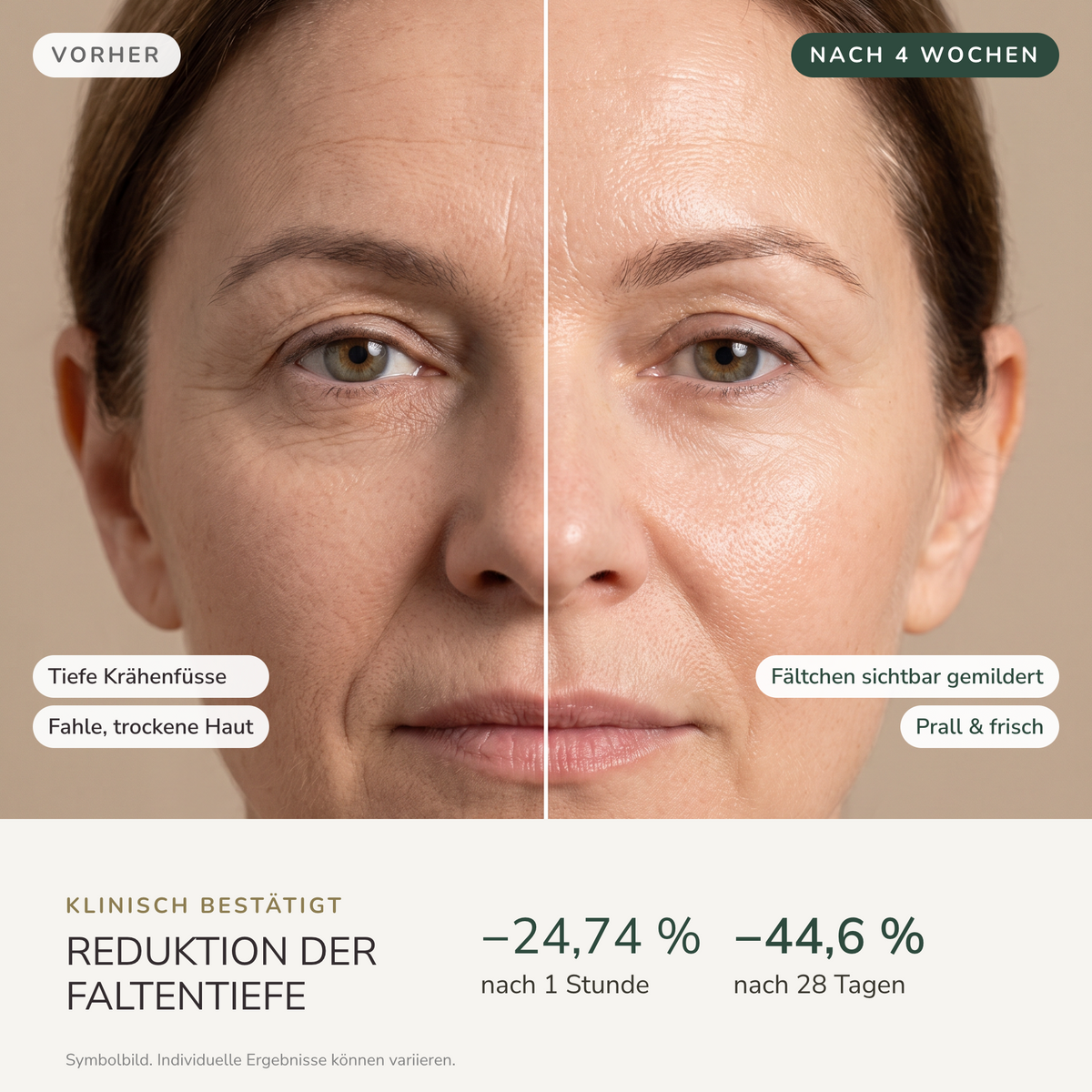 Natural Skin Lifting Serum | 30 ml